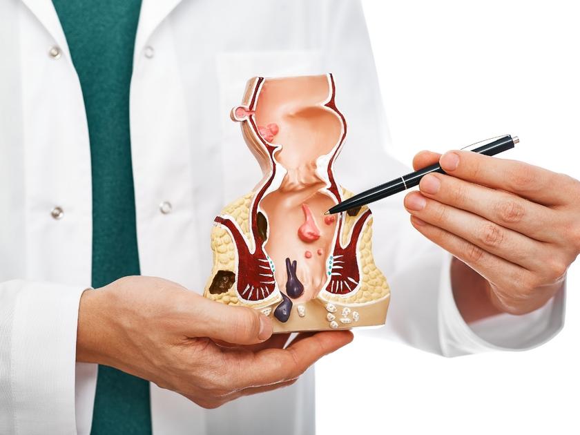 best-rectal-prolapse-treatment-meerpet